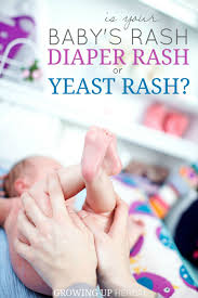 Image result for newborn diaper rash