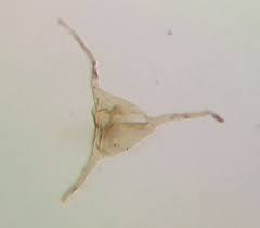 Image result for Acritochaete