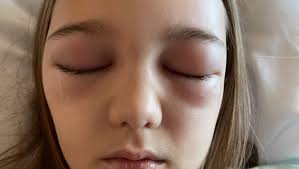 Fundraiser for Chris Jennings by Jana Mullinax : Help with medical and  monthly bills