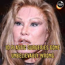 10 Plastic Surgeries Gone Unbelievably Wrong