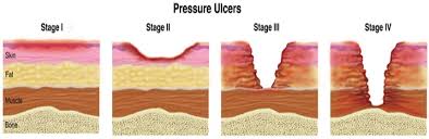Image result for Comprehensive Skin Integrity Assessment