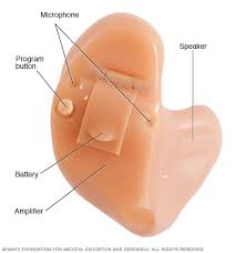 There are two hearing aids stores near me. Hearing Loss Diagnosis And Treatment Mayo Clinic