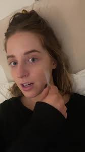 That time of month #skinshedding