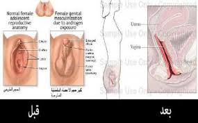معلومات تهمك عن الجراحات الحساسه