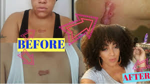 Check spelling or type a new query. Keloid Makeup Saubhaya Makeup