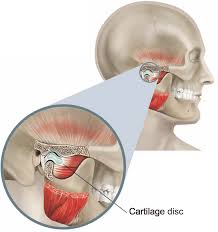 Image result for Jaw Dislocation
