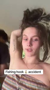 Visual Video Viral Hooks Accident