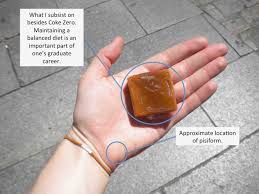 Image result for Pisiform Bone