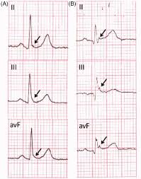 Image result for J Wave