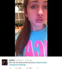 Viva OMG! Labios de Kylie Jenner causan peligroso trending topic.  http://bit.ly/1aOZ5vk