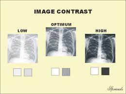 High Contrast Vs Low Contrast Radiography Google Search Radiology Technologist Xray Tech Radiology Student
