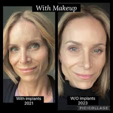 So since Irene shut down i assume Eagle Nest gon get a heavy dose!!🤔🫣