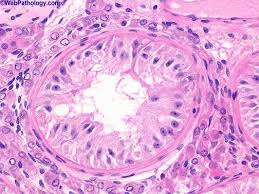 Über 7 millionen englischsprachige bücher. Webpathology Com A Collection Of Surgical Pathology Images