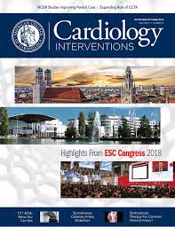 182509 3d models found related to scad fit. About Scad Coronary Arteries Cardiology Arteries