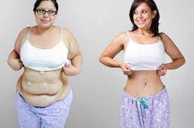 Gastric sleeve surgery is a fantastically effective way to lose weight, but are you really ready to take this huge step? 6 Tips For Before And After Gastric Sleeve Surgery Las Vegas Bariatrics