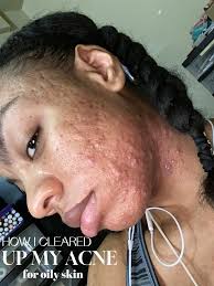 Blake Lively Shark Movie