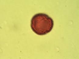 Image result for Dissotis hensii