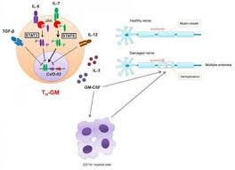 Multiple Sclerosis Subtypes Symptoms Diagnosis And