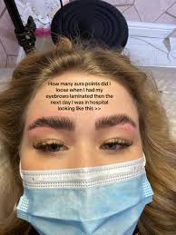 Allergic Reaction to Tinted Eyebrows