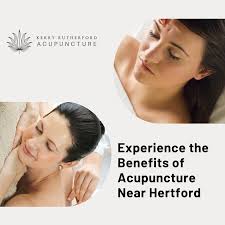 How Long Does It Take for Acupuncture to Work?