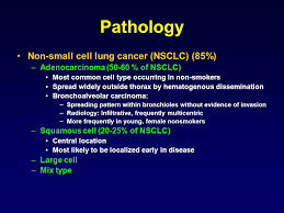 A thickening or lump in any part of the body; Lung Cancer Dr Basak Oyan Uluc Yeditepe University Hospital Ppt Video Online Download