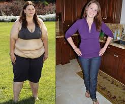 Gastric Balloon Reviews The Patient Perspective Bariatric Surgery Source