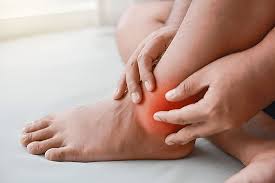 Image result for gout