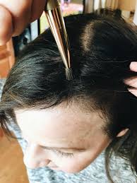 I've tried downing castor oil but that stuff is gross. How To Deal With Hair Fall After Delivery
