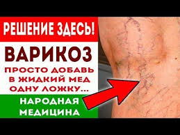 как убрать сосудистую сетку на лице в домашних условиях Chtoby Izbavitsya Ot Varikoza Prosto Dobav V Zhidkij Med Natertyj Narodnaya Medicina Pro Zdorove Youtube Varikoz Domashnee Lechenie Zdorove