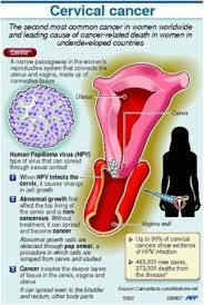 If there are signs and symptoms of cervical cancer, or if the pap test reveals abnormal cells, a doctor may recommend additional tests. Home Kits Encourage Women To Spot Early Signs Of Cervical Cancer
