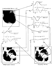Image result for Nuclear Ventriculogram