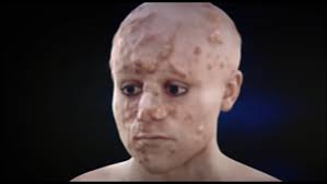 Elizabeth Mitchell (1832-1851)