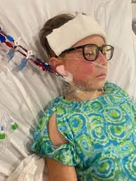 Parents question federal response after son's near-death encounter with E.  coli