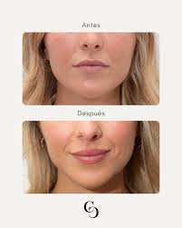 5 cosas que quizás no sabías… 👀 1️⃣ Para ver resultados reales de un  tratamiento, necesitas al menos 6 semanas. 2️⃣ La alopecia puede tratarse y  controlarse a largo plazo, con resultados