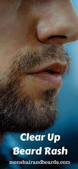 Learn How To Fix Red Flaky Skin Under The Beard And Beard Rash Simple Solutions To Skin Problems While Growing A Beard Beard Rash Red Flaky Skin Flaky Skin