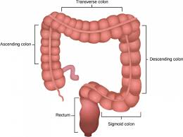 Image result for Colorectal Cancer