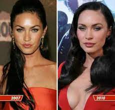 Before And After Plastic Surgery Megan Fox Megan Fox Plastic Surgery Plastic Surgery Gone Wrong Celebrity Plastic Surgery