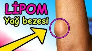 Yuzdeki Sert Yag Bezesi Alinmasi Operasyonu Youtube Video Izle Indir