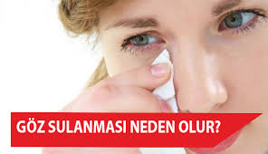 Goz Sulanmasi Neden Olur Optik Gazete
