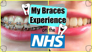 Keep the area between the brace and teeth tidy and free of plaque construct up. How To Get Braces Uk Arxiusarquitectura
