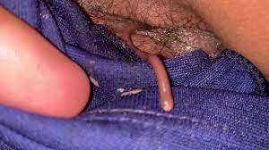 Worm in coCk - extreme close-up view