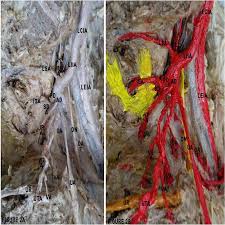 I would highly recommend b & p painting, llc and will i was referred to b & p painting, llc by another satisfied customer. A Before Painting B After Painting Lcia Left Common Iliac Artery Download Scientific Diagram