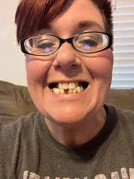 Is there an affordable dentist in Conroe for a dental emergency, likely an  abscess