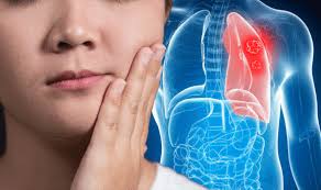 Lung cancer stage 4 can not be treated, so the question arises only about how much a person left to live. Lung Cancer Symptoms Signs Of Advanced Stages Include Superior Vena Cava Obstruction Express Co Uk
