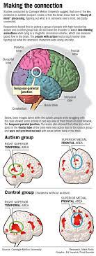 First of all, children with asd generally have bigger brains. Temporal And Frontal Lobe Activation In Asd Individuals The Autistic Brain Autistic Autism Education