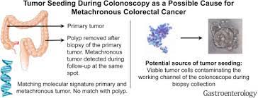 According to the american cancer society, about 135,430 people were diagnosed with colon cancer in 2014.that. Tumor Seeding During Colonoscopy As A Possible Cause For Metachronous Colorectal Cancer Gastroenterology