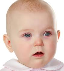 Sometimes it means nothing, especially when infrequent. Pink Eye In Babies Causes Symptoms And Treatment