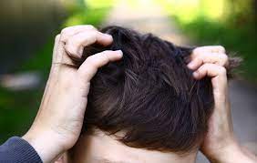 Can you get lice with a buzz cut? How To Get Rid Of Head Lice Men S Health