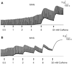 It's included for compatibility with caffeine user humancar2n has put together a short youtube video showing how the app works. Caffeine As A Tool To Investigate Sarcoplasmic Reticulum And Intracellular Calcium Dynamics In Human Skeletal Muscles Springerlink