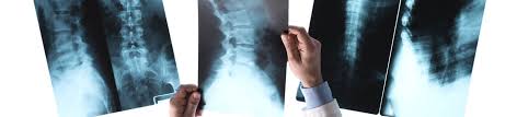 84 likes · 3 talking about this · 524 were here. Spine Clinic Locations Virginia Mason Medical Center Seattle Wa